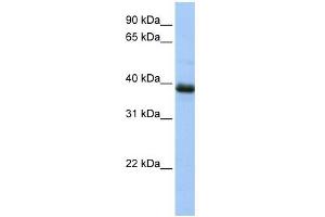 SPO11 antibody used at 1 ug/ml to detect target protein.