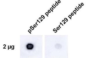 Dot Blot analysis using Rabbit Anti-Alpha Synuclein pSer129 Monoclonal Antibody, Clone J18 (ABIN6932862).
