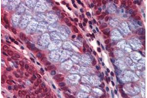 Human Colon: Formalin-Fixed, Paraffin-Embedded (FFPE) (Calcyphosine 2 antibody  (Internal Region))