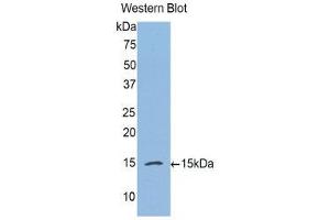 Western Blotting (WB) image for anti-Complement Factor B (CFB) (AA 270-388) antibody (ABIN1175357) (Complement Factor B antibody  (AA 270-388))