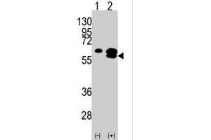 Western blot analysis of CAMK1G (arrow) using rabbit polyclonal CAMK1G polyclonal antibody . (CAMK1G antibody  (C-Term))