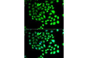 Immunofluorescence analysis of A549 cell using TCEAL8 antibody. (TCEAL8 antibody)