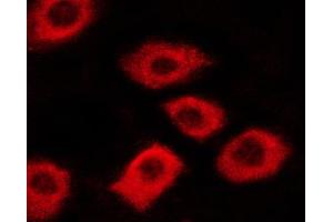 ABIN6267340 staining A431 cells by ICC/IF.