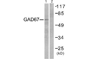 Western blot analysis of extracts from LOVO cells, using GAD67 antibody. (GAD antibody)