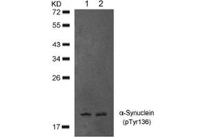 Image no. 1 for anti-Synuclein, alpha (SNCA) (pTyr136) antibody (ABIN401576) (SNCA antibody  (pTyr136))