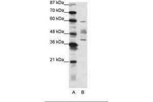 Image no. 1 for anti-Aprataxin (APTX) (N-Term) antibody (ABIN202287) (Aprataxin antibody  (N-Term))