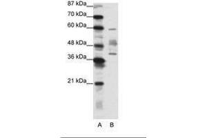 Image no. 1 for anti-Aprataxin (APTX) (N-Term) antibody (ABIN202287)