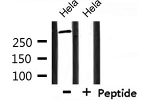 Western blot analysis of extracts from Hela , using Factor VIII Antibody. (Factor VIII antibody)