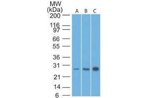 Western Blot Analysis of Bcl-2 in human A) HeLa, B) A549 and C) MCF7 lysate using Bcl-2 Mouse Monoclonal Antibody (8C8). (Bcl-2 antibody  (AA 41-54))