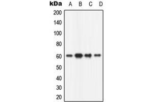 Western blot analysis of CaMK2 beta expression in HeLa (A), mouse brain (B), rat brain (C), PC12 (D) whole cell lysates. (CAMK2B antibody  (N-Term))