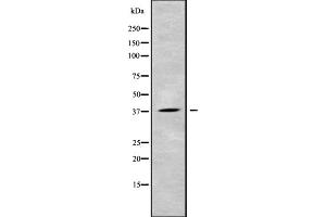Western blot analysis of CEACAM8 using HeLa whole cell lysates (CEACAM8 antibody  (N-Term))