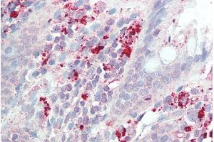 ABIN2613443 (5µg/ml) staining of paraffin embedded Human Colon. (IL3RA antibody  (Internal Region))