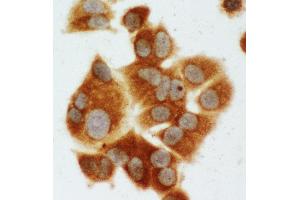 Anti-MEK1 antibody, ICC ICC: MCF-7 Cell (MEK1 antibody  (C-Term))