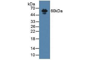 Detection of ENG in Mouse Serum using Polyclonal Antibody to Endoglin (ENG) (Endoglin antibody  (AA 27-137))