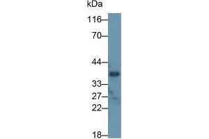 Detection of OGN in Rat Lung lysate using Polyclonal Antibody to Osteoglycin (OGN) (OGN antibody  (AA 180-298))