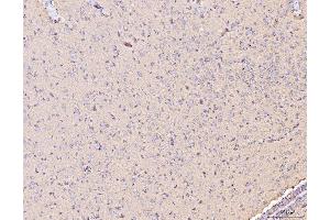 IHC analysis of MT-CO2 using anti-MT-CO2 antibody (ABIN7599081).