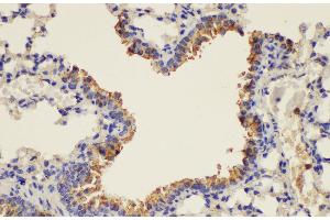 Immunohistochemistry of paraffin-embedded Mouse lung using PLAUR Ployclonal Antibody at dilution of 1:200. (PLAUR antibody)