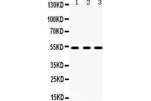 Western Blotting (WB) image for anti-5-Hydroxytryptamine (serotonin) Receptor 2A (HTR2A) (AA 400-431), (C-Term) antibody (ABIN3042729)