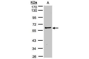 WB Image Sample(30 μg of whole cell lysate) A:Raji, 10% SDS PAGE antibody diluted at 1:2000 (RIPK2 antibody)