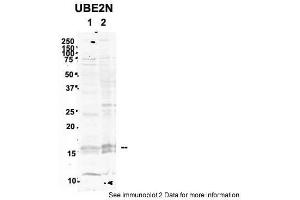 Sample Type: 1. (UBE2N antibody  (Middle Region))