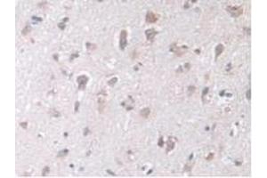 IHC-P analysis of Human Brain Tissue, with DAB staining. (STIP1 antibody  (AA 1-169))