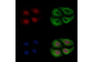ABIN6256199 and ABIN6267172 staining Heat-shock treated Hela cells by IF/ICC.