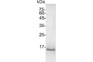 SDS-PAGE (SDS) image for Interleukin 21 (IL21) (Active) protein (His tag) (ABIN7884475)