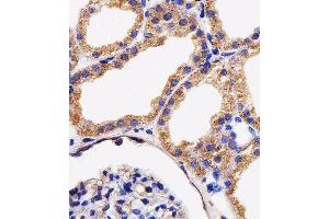 Immunohistochemical analysis of paraffin-embedded H. (AK4 antibody  (AA 119-153))
