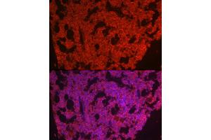 Immunofluorescence analysis of mouse bone marrow cells using CSF1R Rabbit pAb (ABIN3017197, ABIN3017198, ABIN3017199 and ABIN6219993) at dilution of 1:100 (40x lens). (CSF1R antibody)