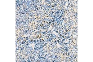 Immunohistochemistry analysis of paraffin-embedded mouse speen using,NLRP1 (ABIN7074850) at dilution of 1: 1000 (NLRP1 antibody)