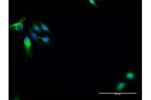 Immunofluorescence of purified MaxPab antibody to MAP7 on HeLa cell. (MAP7 antibody  (AA 1-749))