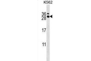 Western Blotting (WB) image for anti-RCAN Family Member 3 (RCAN3) antibody (ABIN2997962) (RCAN3 antibody)