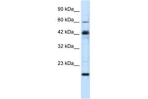 Western Blotting (WB) image for anti-Zinc Finger Protein 24 (ZNF24) antibody (ABIN2460740) (ZNF24 antibody)