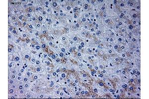 Immunohistochemical staining of paraffin-embedded liver tissue using anti-NEUROG3mouse monoclonal antibody. (Neurogenin 3 antibody)