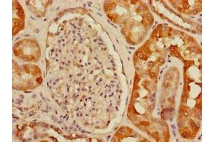 Immunohistochemistry of paraffin-embedded human kidney tissue using ABIN7175150 at dilution of 1:100 (USHBP1 antibody  (AA 1-260))