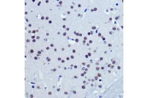 Immunohistochemistry of paraffin-embedded Mouse brain using Vgll4 Rabbit pAb (ABIN7271320) at dilution of 1:100 (40x lens). (VGLL4 antibody)