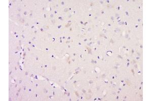 Paraformaldehyde-fixed, paraffin embedded rat brain, Antigen retrieval by boiling in sodium citrate buffer (pH6) for 15min, Block endogenous peroxidase by 3% hydrogen peroxide for 30 minutes, Blocking buffer (normal goat serum) at 37°C for 20min, Antibody incubation with Rabbit Anti-Neurotrophin 3 Polyclonal Antibody, Unconjugated  ) at 1:200 overnight at 4°C, followed by a conjugated secondary for 90 minutes and DAB staining (Neurotrophin 3 antibody  (AA 19-100))