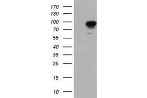 Western Blotting (WB) image for anti-phosphoinositide-3-Kinase Adaptor Protein 1 (PIK3AP1) antibody (ABIN1496821) (PIK3AP1 antibody)