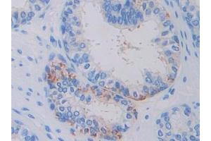 Used in DAB staining on fromalin fixed paraffin- embedded glioma tissue (Factor VII antibody  (AA 334-452))