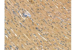 ABIN7094629 and ABIN7098679 at 1/100 staining Rat heart tissue by IHC-P. (TOM1L2 antibody  (Internal Region))