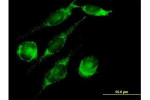Immunofluorescence of purified MaxPab antibody to PECI on HeLa cell. (PECI/ECI2 antibody  (AA 1-364))