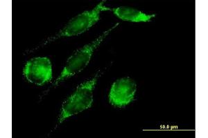 Immunofluorescence of purified MaxPab antibody to PECI on HeLa cell.