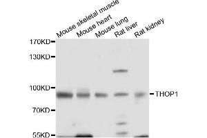 Western blot analysis of extracts of various cell lines, using THOP1 antibody. (Thimet Oligopeptidase 1 antibody)