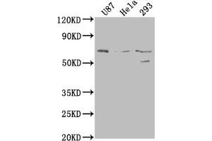 Western Blot Positive WB detected in: U87 whole cell lysate, Hela whole cell lysate, 293 whole cell lysate All lanes: PTGS2 antibody at 1:1000 Secondary Goat polyclonal to rabbit IgG at 1/50000 dilution Predicted band size: 69 kDa Observed band size: 69 kDa (PTGS2 antibody  (AA 18-268))