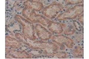 IHC-P analysis of Human Kidney Tissue, with DAB staining. (LGALS8 antibody  (AA 1-317))