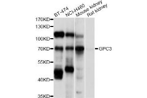 Western blot analysis of extracts of various cell lines, using GPC3 antibody (ABIN5997818) at 1/1000 dilution. (Glypican 3 antibody)