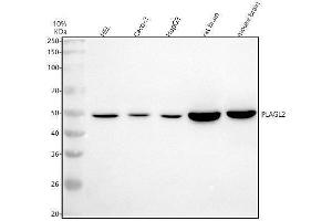 Western blot analysis of PLAGL2 using anti-PLAGL2 antibody (ABIN7600991).