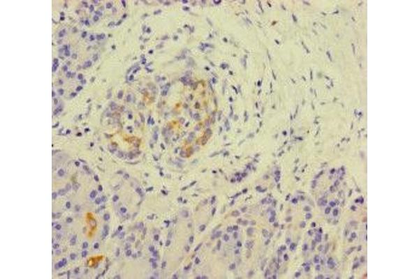 KLHL3 antibody  (AA 1-301)