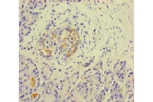 Immunohistochemistry of paraffin-embedded human pancreatic tissue using ABIN7157290 at dilution of 1:100 (KLHL3 antibody  (AA 1-301))