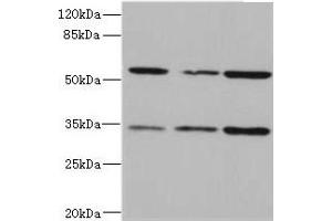Western blot All lanes: IL17RB antibody at 2.